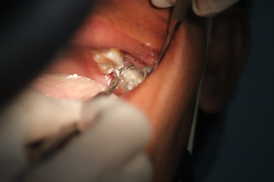 Photo dental eruption